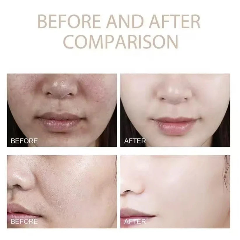 Dr. Melaxin™ Korean Beauty Rice Peel Shot - Face Serum