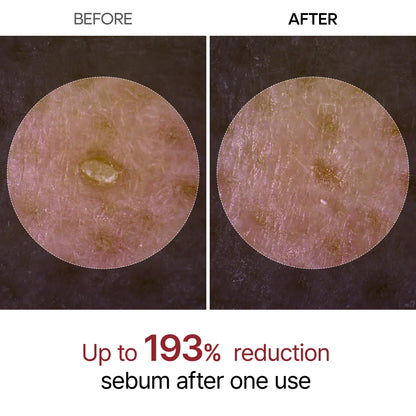 Dr. Melaxin™ Korean Beauty Rice Peel Shot - Face Serum